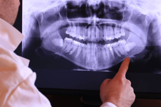 Best Emergency Care for Gum Disease in Pittsboro, IN