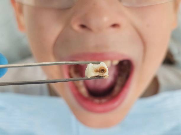 Best Emergency Treatment for Jaw Pain or Injury in Pittsboro, IN